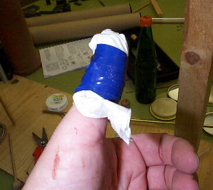Finger